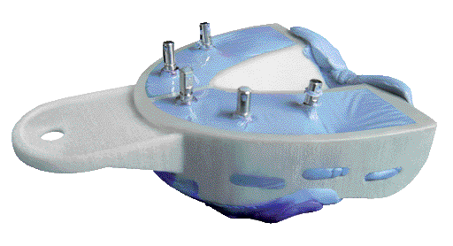 PORTAIMPRONTE MIRATRAY IMPLANT S2 6