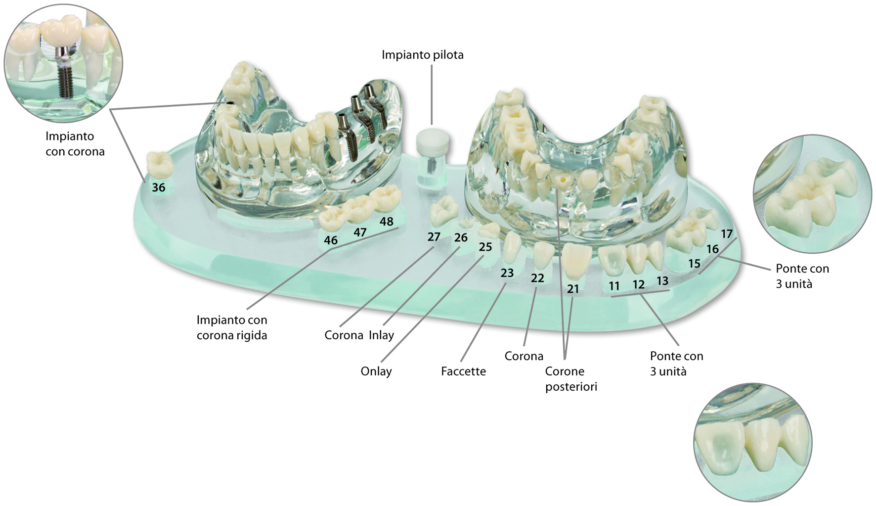 MODELLO STUDIO IMPLANT C+B
