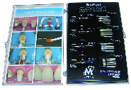 PERNI ENA POST KIT 2% 20 PZ.+4 FRES