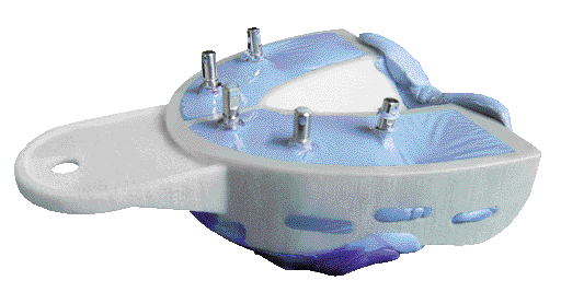 PORTAIMPRONTE MIRATRAY IMPLANT KIT