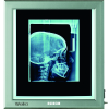 Radiografia - NEGATOSCOPIO SLIM LED DA PARETE