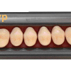 Laboratorio - SR ORTHOTYP X8 COL.1D N2S IVOCLAR